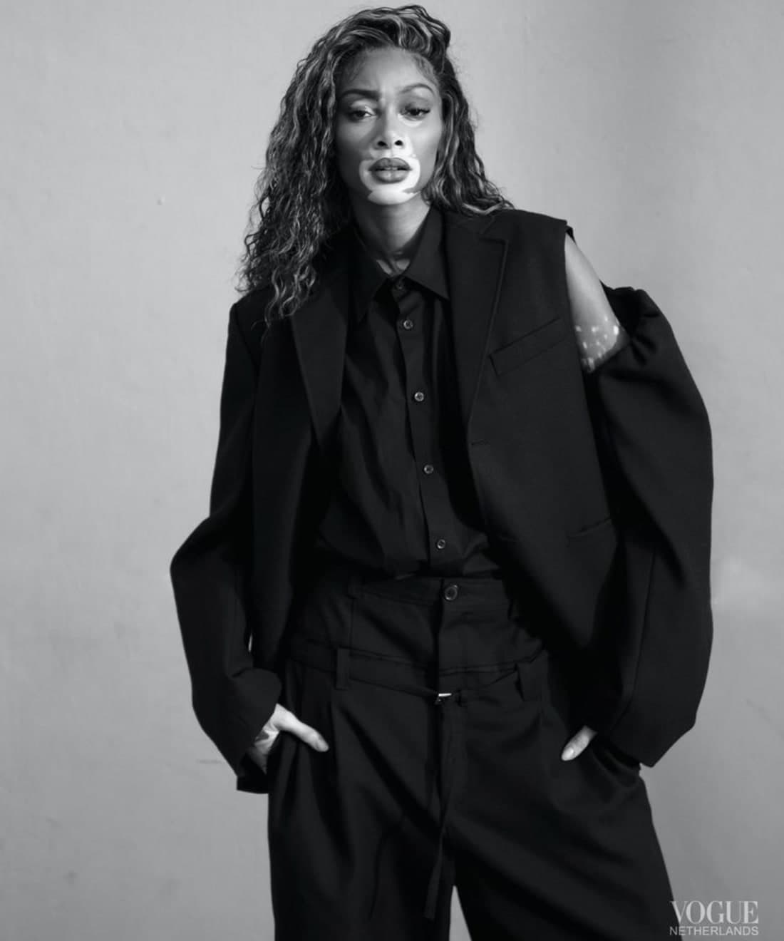 winnie-harlow-by-nikki-esser-1.jpg