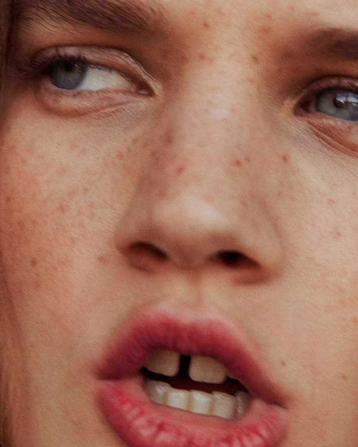 the-skin-youre-in-3.jpg