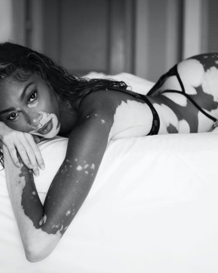 winnie-harlow-by-nikki-esser-2.jpg