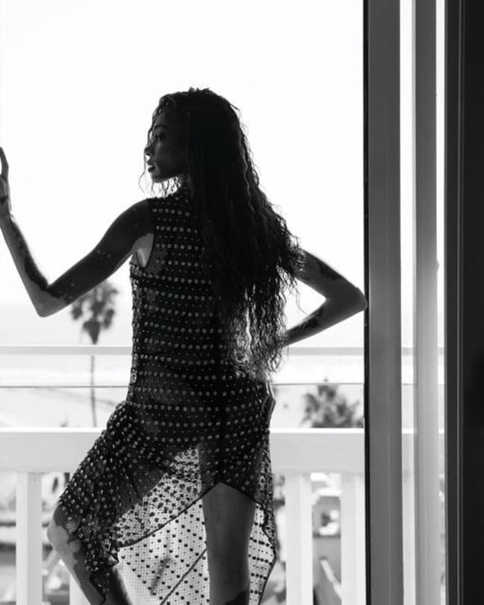 winnie-harlow-by-nikki-esser-5.jpg